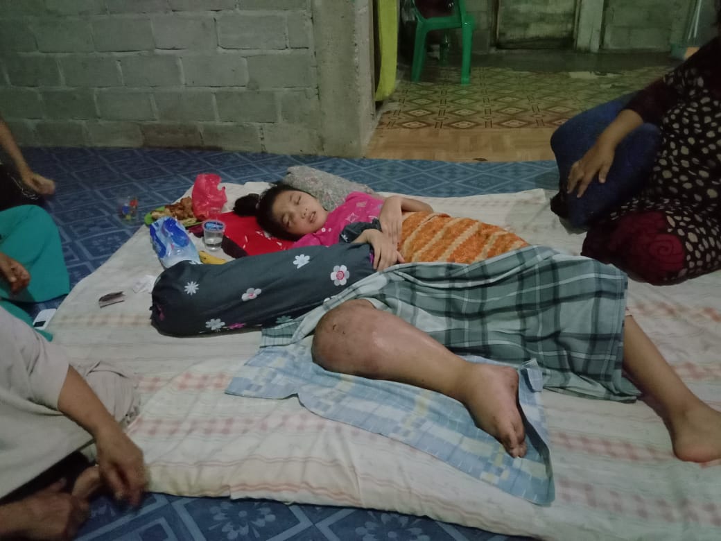 KEPEDULIAN ANDA DIPERLUKAN, Putri Ayuni Berharap Uluran Tangan para Pesedekah dan donatur