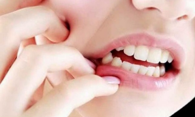 Inilah 6 Obat Sakit Gigi Alami yang Ampuh Serta Pengobatan Instan Sebelum ke Dokter Gigi, Yuk Lihat  Inilah 6 Obat Sakit Gigi Alami yang Ampuh Serta Pengobatan Instan Sebelum ke Dokter Gigi, Yuk Lihat