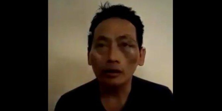 Polisi Bentuk Tim Buru Penculik yang Menganiaya Ninoy Karundeng