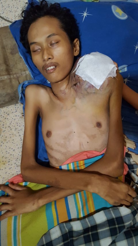 Rafii Putra, Penderita Osteosarcoma Asal Teluk Pinang, Inhil Butuh Uluran Tangan