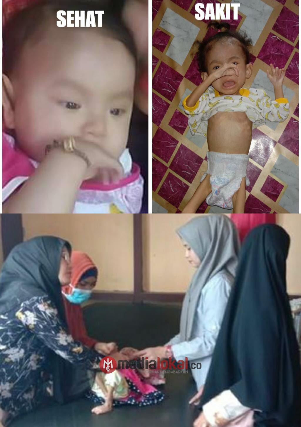 Alami Gizi Buruk Setahun Belakangan, Kini Isyana Terbaring Lemah di RSUD Puri Husada Tembilahan