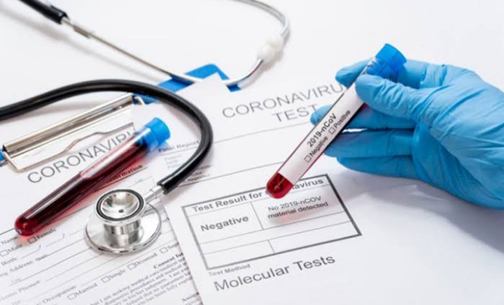 Kembali Bertambah Lagi, Kasus Positif Covid-19 di Indonesia Jadi 139.549 Orang