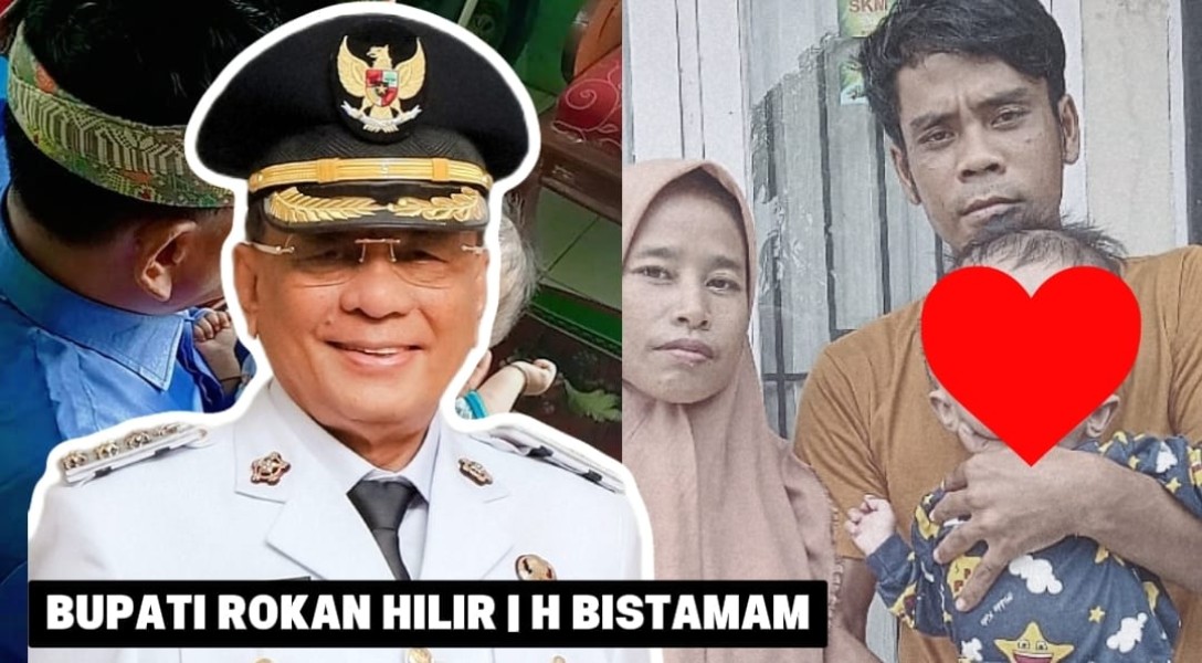 Koordinasikan Pihak Terkait, Bupati Rokan Hilir H Bistamam Inginkan Anak Penderita Hidosefalus Ditangani dengan Tepat