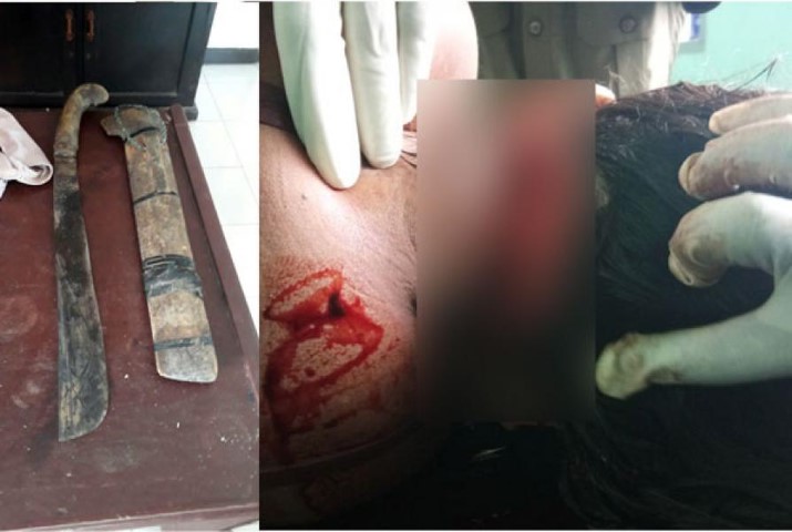 Tragis! Seorang Suami di Inhu ini Nekat Tebas Leher Istrinya Gara-Gara ini 