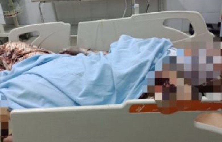 Cemburu, Iwan Bakar Pacar Hidup-hidup