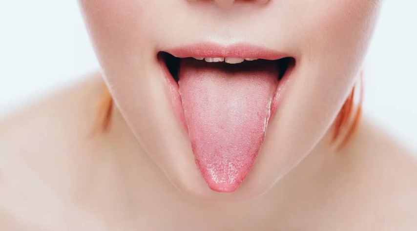 Warna Lidah Bisa Menunjukan Kondisi Kesehatan Anda