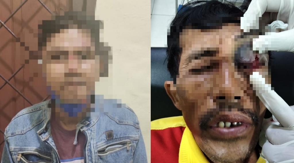 NGERILAH POKOKNYA!!! Dahlah Dibayarkan Makan, Pria Ini Malah Tusuk Pulak Mata Tukang Ojek