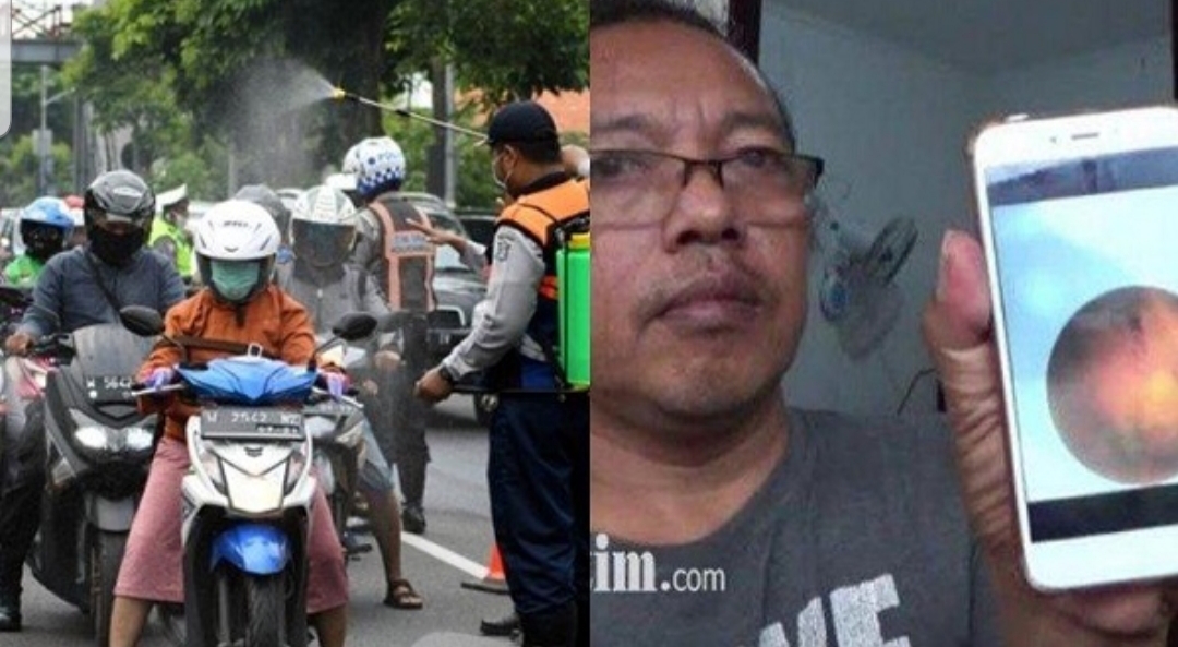 Pria ini Alami Pecah Pembuluh Darah Mata, Katanya Sebelumnya Sempat Terkena Semprotan Desinfektan