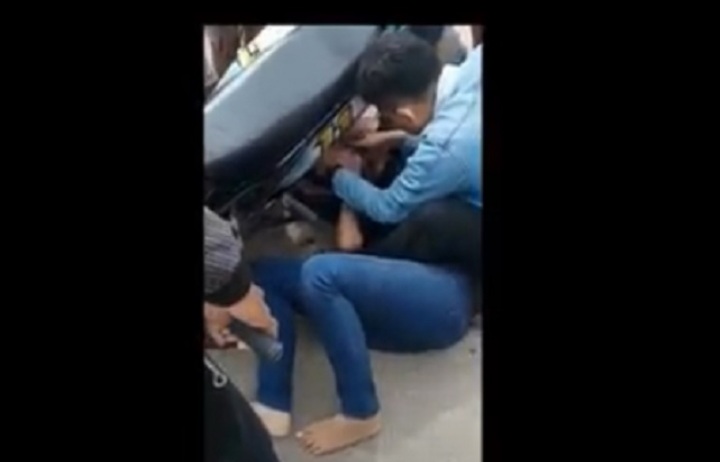 Mengerikan! Gamis Tersangkut Roda Motor, Tangan Wanita Ini Patah Tiga Mengerikan! Gamis Tersangkut Roda Motor, Tangan Wanita Ini Patah Tiga