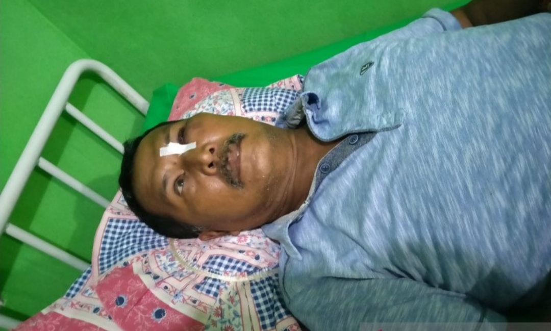 Sosialisasi Covid-19 ke Warung Domino, Kepala Kampung ini Lebam-lebam Dianiaya