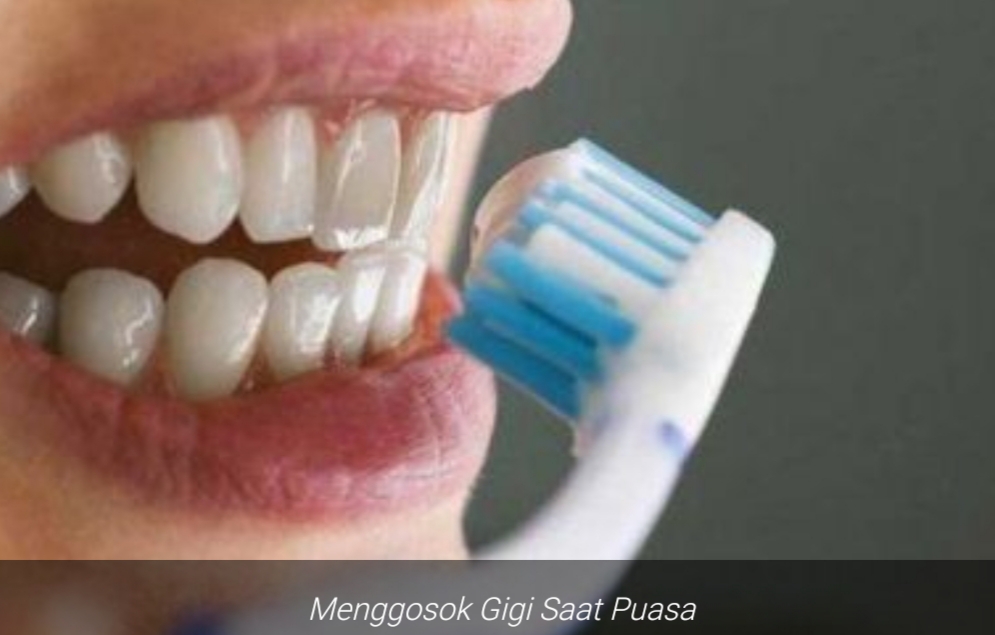 Menggosok Gigi Saat Berpuasa, Apa Itu Diperbolehkan? Lihat Disini