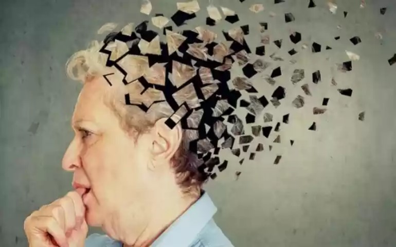 Simak, Ini Gejala Seseorang Mengidap Demensia