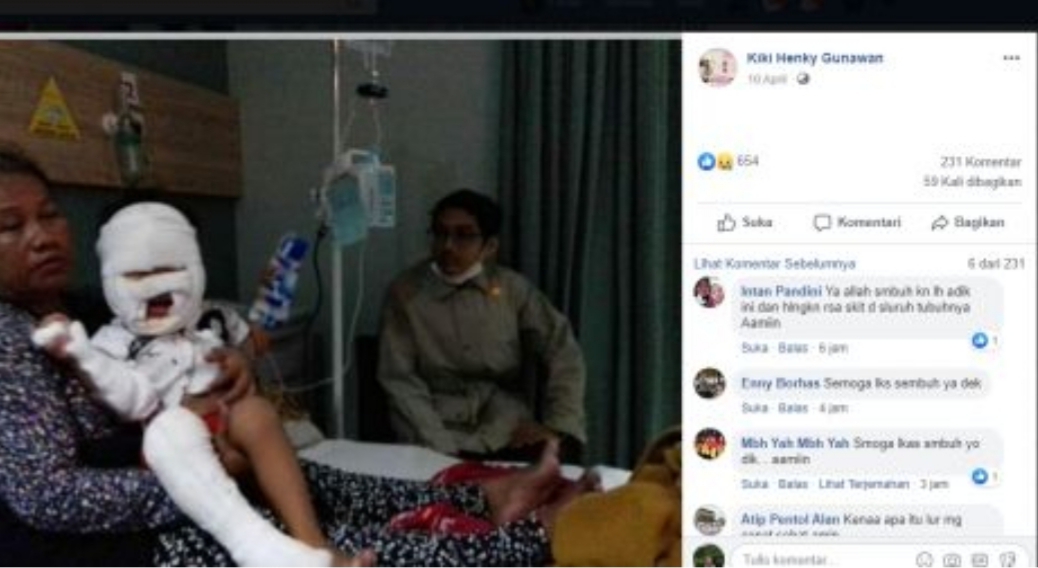 Astaga! Balita Ini Terbakar Gara-gara Bawa Hand Sanitizer ke Tempat Pembakaran Sampah Astaga! Balita Ini Terbakar Gara-gara Bawa Hand Sanitizer ke Tempat Pembakaran Sampah