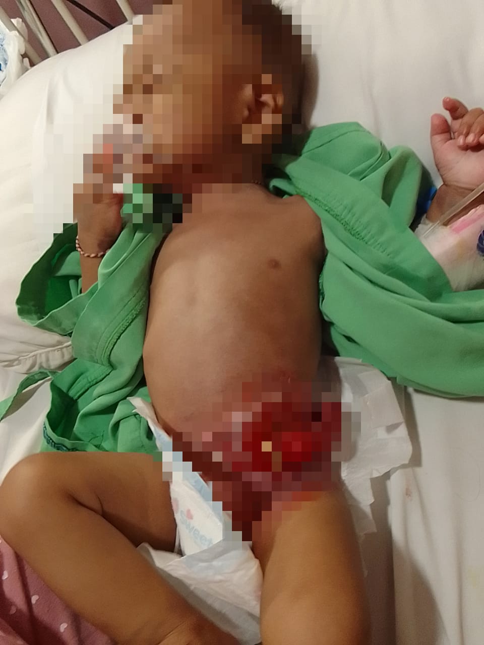 Paska Operasi Aidil di RS Swasta, Keluarga Terhutang 40 Jt, Kini Butuh Uluran Para Donatur