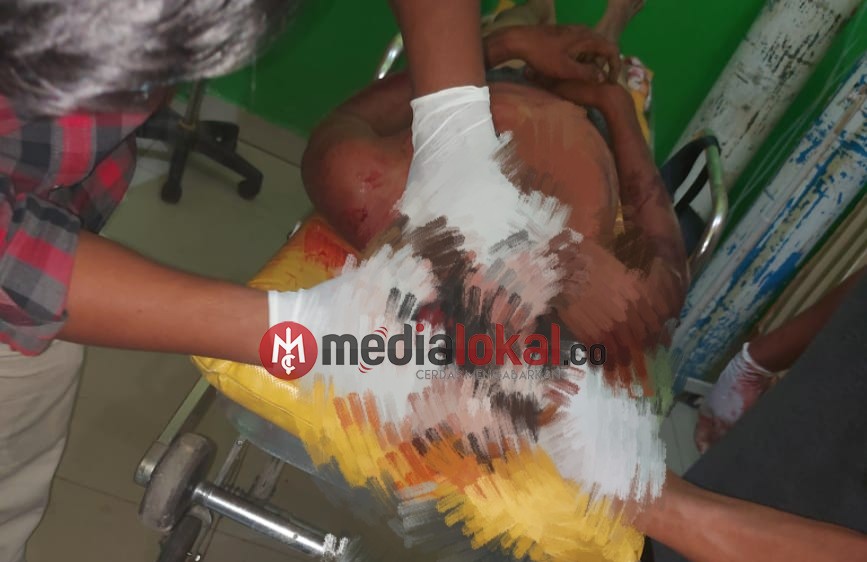 Polisi Dalami Kasus Penemuan Mayat Bersimbah Darah di Bangko Pusako