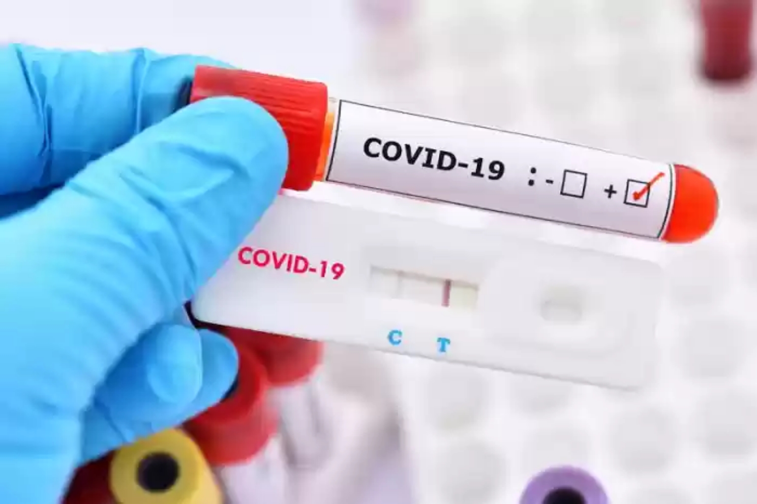 Bisa Dilakukan Sendiri, Swab Antigen Nasal Jadi Pilihan untuk P3K Pandemi