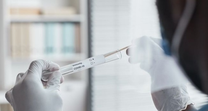 Beberapa Faskes di Batam Sudah Turunkan HArga Tes PCR Hampir 50 Persen