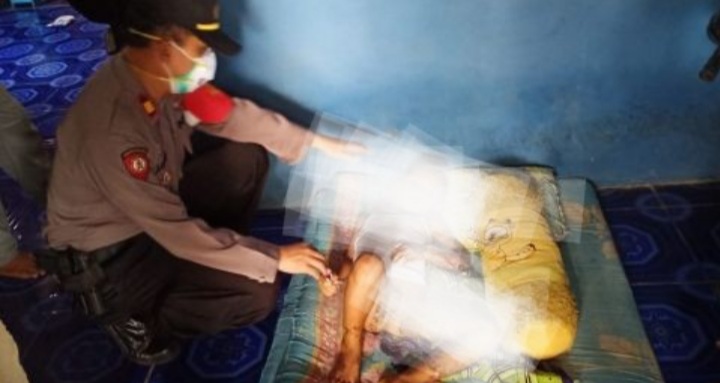 Naas, Gegara Main Hand Sanitizer, Tubuh Bocah Ini Terbakar Naas, Gegara Main Hand Sanitizer, Tubuh Bocah Ini Terbakar