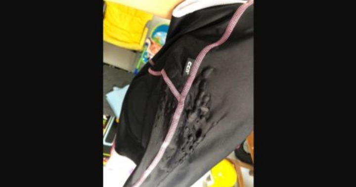 Diduga Disiram Air Keras, 3 Pesepeda Ini Rasakan Panas di Kulit