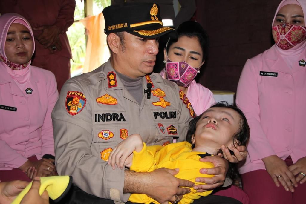 Haru dan Tangis Saat Kunjungan Kapolres Bengkalis AKBP Indra Wijatmiko, S.I.K ke Kediaman Anak Penderita Hidrosefalus