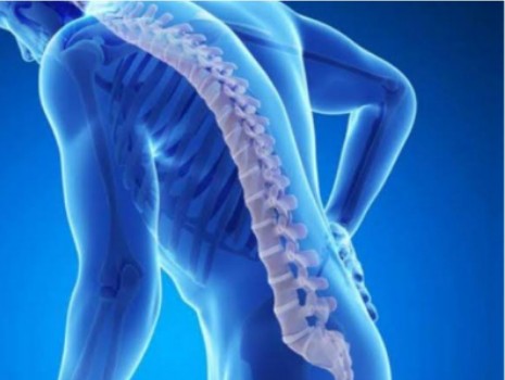 Rahmi Indrasuri: dengan Rutin Berolahgra dan Memastikan Asupan Kalsium Cegah Osteoporosis