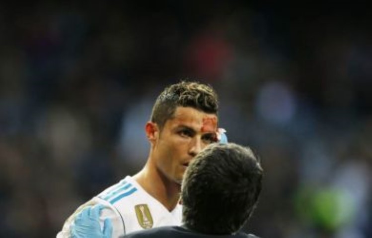 Ronaldo Berdarah-darah, Sang Adik Curhat Begini