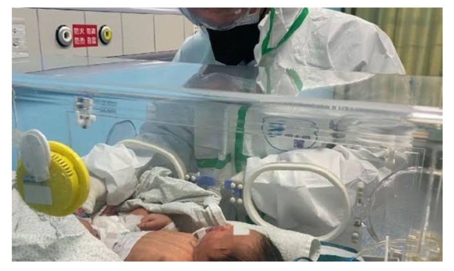 Begini Kondisi Balita 2 Tahun Positif COVID-19 di Riau, Yuk Lihat