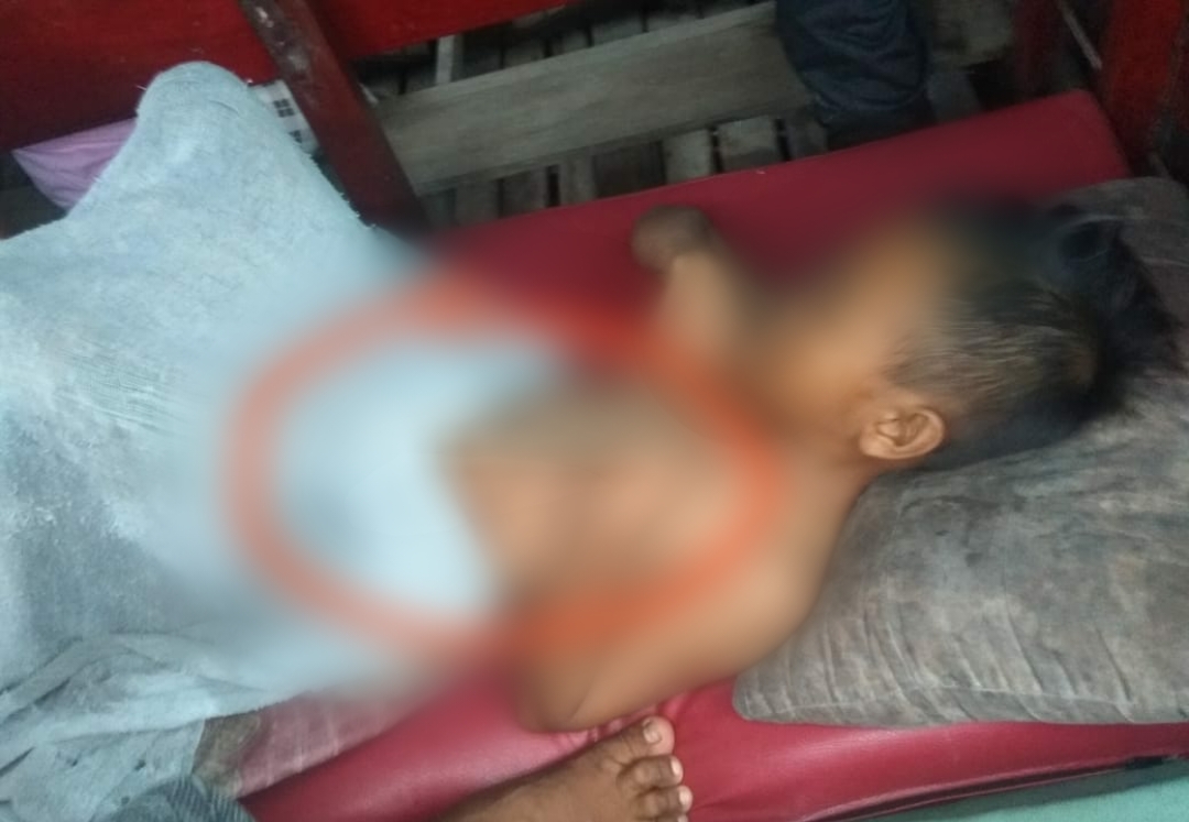 Kayu Menancap di Perut, Anak Laki-laki di Inhil ini Perlukan Uluran Tangan